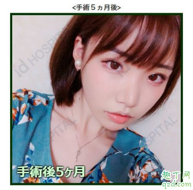 深田咏美2019年全副作品封面 深田咏美整容前后比照照4