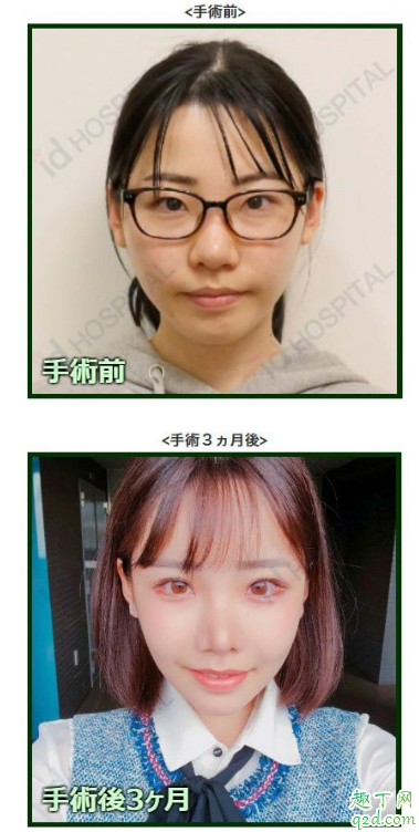 深田咏美2019年全副作品封面 深田咏美整容前后比照照3